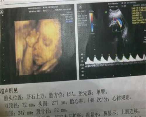 黑龙江找代生孩子40万_怀孕初期能不能吃冒菜