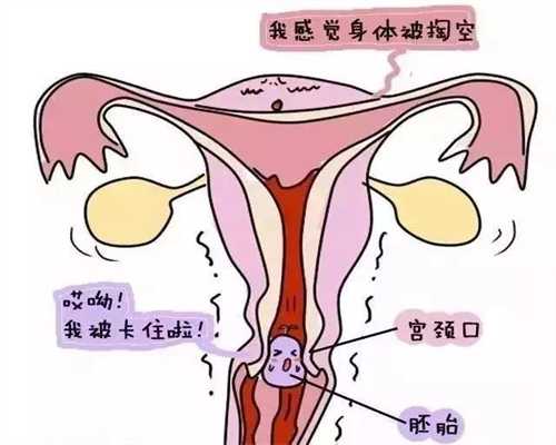 黑龙江卵巢早衰代怀孕哪里有_怀孕初期症状会便