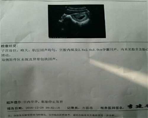 黑龙江代生双胞胎医生咨询_怀孕22周要做哪些胎教
